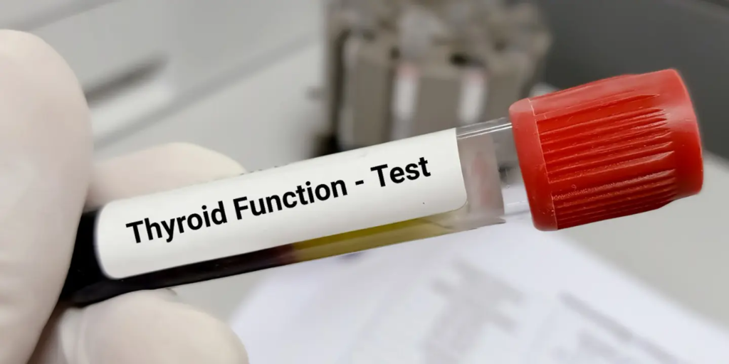 THYROID-TEST
